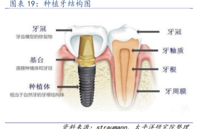 灵魂砍价！“一口牙=小镇一套房”或终结 这一地种植牙材料最高降幅近90%